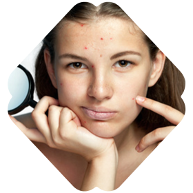 A Person Posing For The Camera